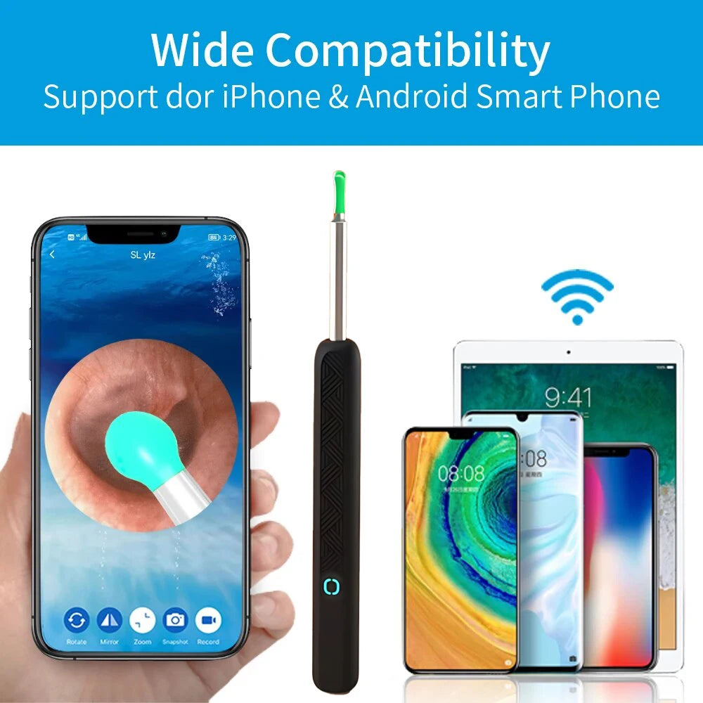 WaxWand - Wax Elimination Otoscope